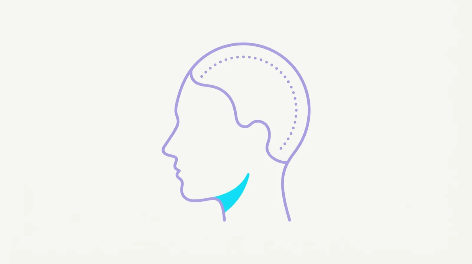 Flat illustration comparing an even, settled hairline with early recession at the temples.